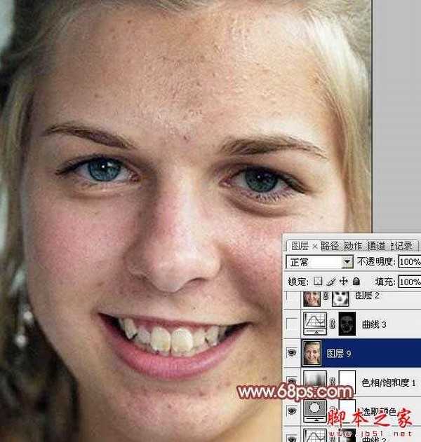 photoshop利用通道为满脸痘痘人物磨皮教程